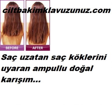 Read more about the article SAÇ UZATAN AMPULLU KARIŞIM