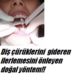 Diş çürüklerini gideren doğal tedavi