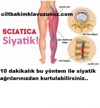 Read more about the article SİYATİK AĞRISINDAN 10 DAKİKADA KURTARAN YÖNTEM