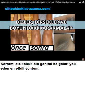 Read more about the article Kararmış Diz Koltuk Altı Genital Bölgeyi  Beyazlatan Yöntem