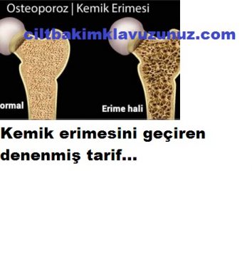 Read more about the article Kemik Erimesini Geçiren Denenmiş Tarif