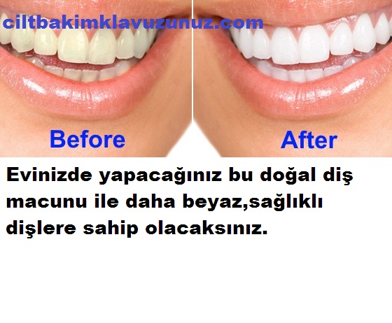 Bu Yağ İle Daha Beyaz Daha Sağlıklı Dişlere sahip Olacaksınız
